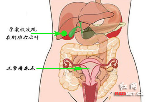 椰網(wǎng)圖片