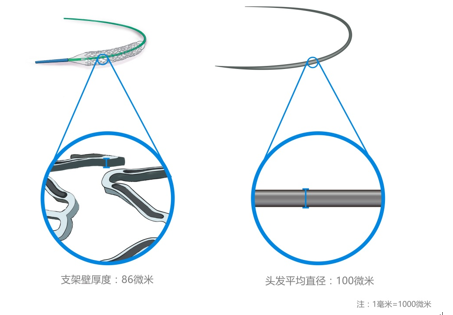 “火鷹支架”壁的凹槽與頭發直徑對比圖